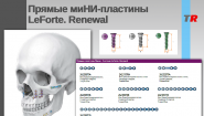 Прямые миНИ-пластины LeForte. Renewal