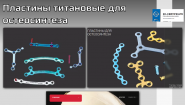 Микро и Мини-пластины для костной пластики 0.6 мм титановые