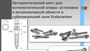 Ортодонтический винт для вспомогательной опоры Ортодонтический винт для вспомогательной опоры